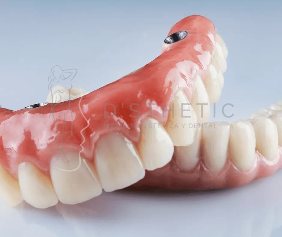 Prótesis Dentales